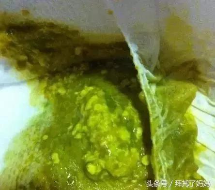 宝宝大便能判断胀不胀气,宝宝大便能看出什么