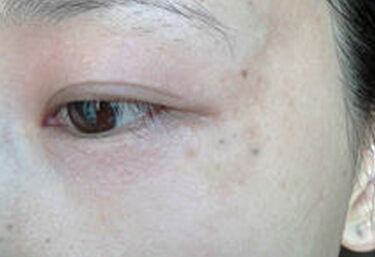 女人有没有妇科病要怎么检查,女人几乎都有妇科病吗