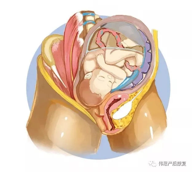 产后各种臀型,产后屁股大瘦