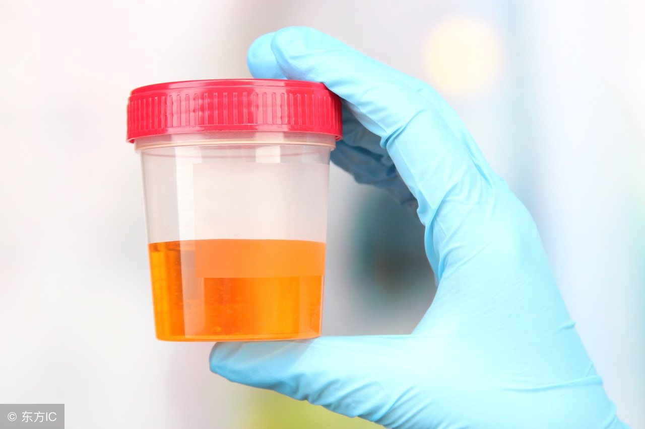 宝宝的尿液出现这2种颜色父母要注意了！