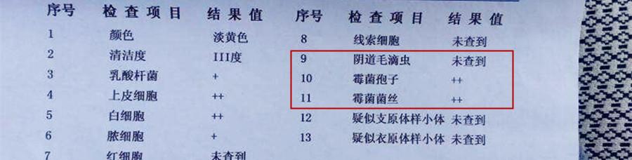 看懂孕检b超单,如何看懂孕检单