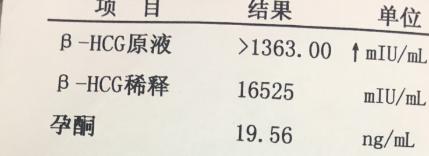 从备孕到怀孕的注意事项,说说怀孕初期经历