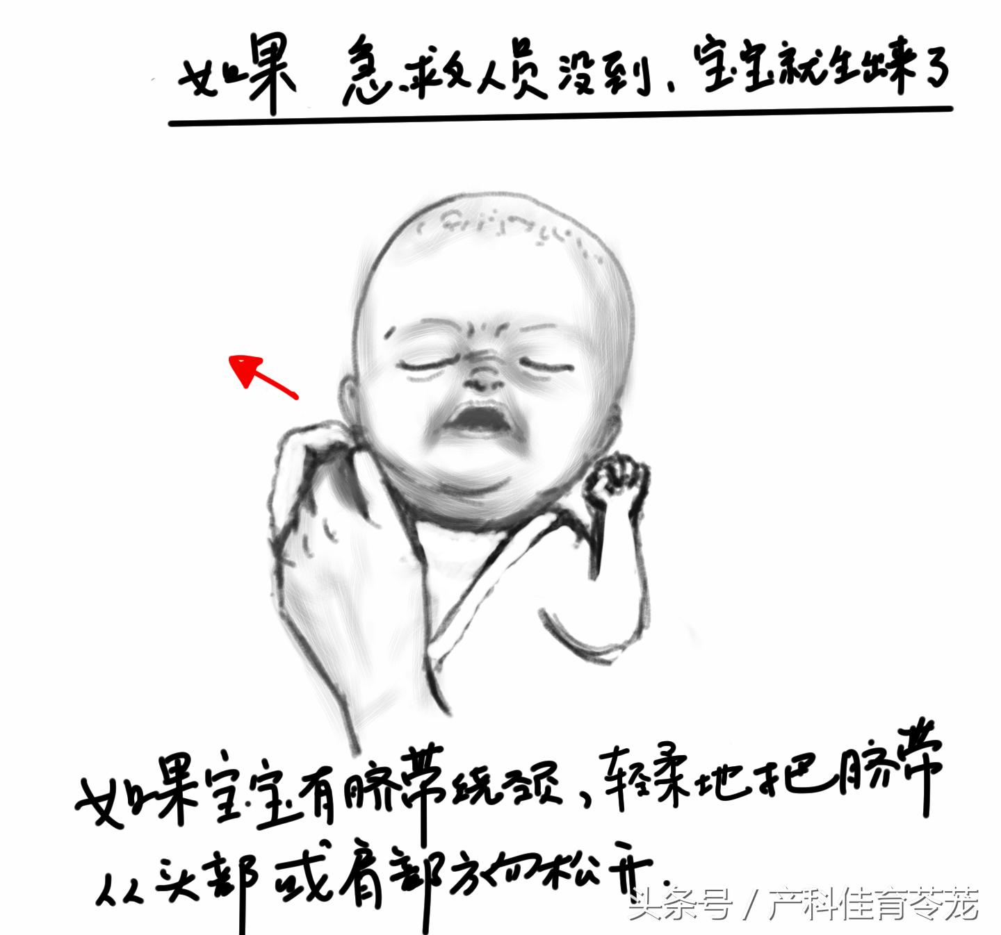 来不及去医院生娃?这套图留着应急