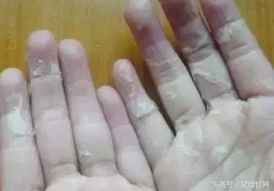 泡泡液对儿童的伤害,小孩泡泡液会导致过敏吗