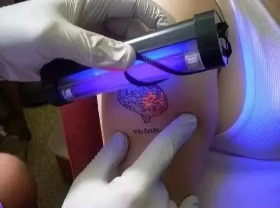 荧光纹身的危害会消除吗,荧光纹身的危害