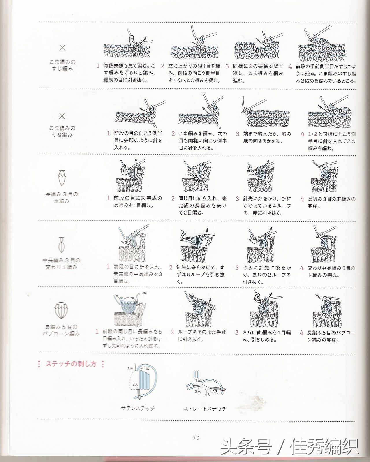 閽╃粐灏忕墿鍥捐В,姣涚嚎閽╃粐瀵挎鐨勯挬缁囨柟娉曚笌鍥捐В