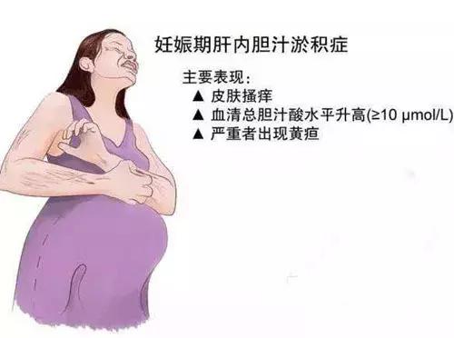 妊娠期胆汁淤积为何会引起瘙痒,妊娠期肝内胆汁淤积是怎么引起的
