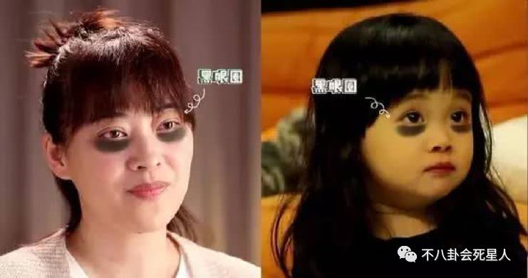 关晓彤鞠婧祎长得矮,黑眼圈眼袋关晓彤