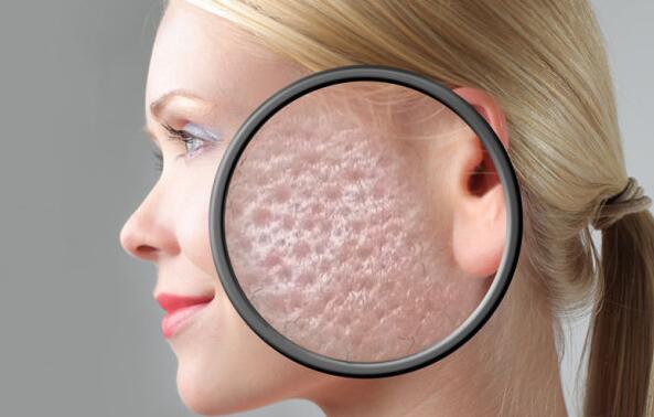 去螨虫的最佳方法脸上,脸上治疗螨虫最好的方法