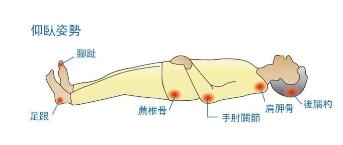 压疮的处理措施,压疮是什么怎么防治