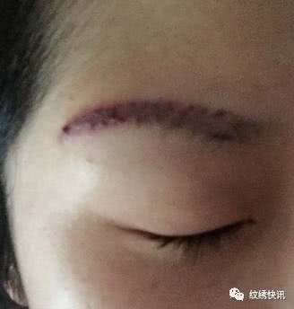 纹眉不要一味的贪图便宜,纹眉不建议吗