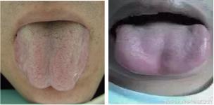 吃饭不消化肚子胀怎么回事,肚子胀不饿怎么治疗