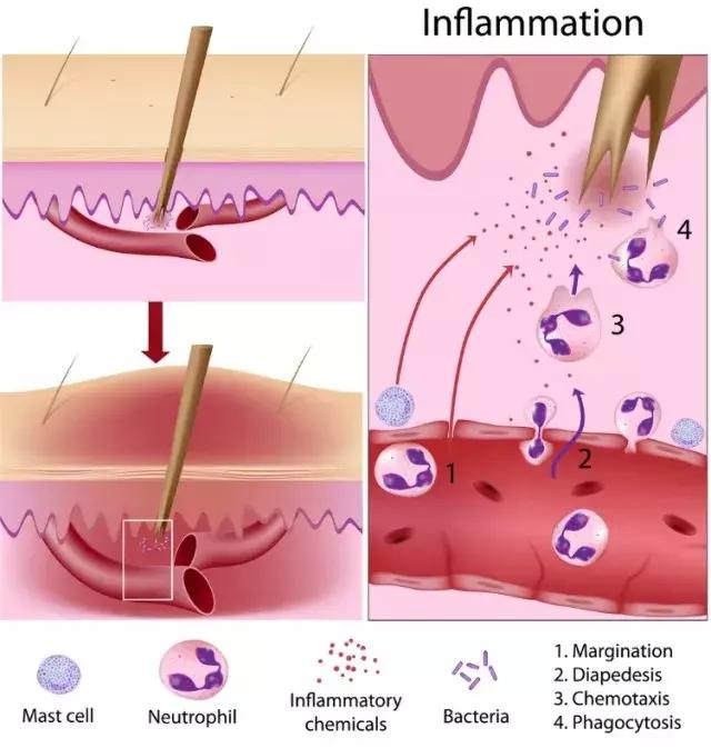 多数跑步伤痛正确处理都会痊愈，超过3个月仍然困扰你就要警惕了