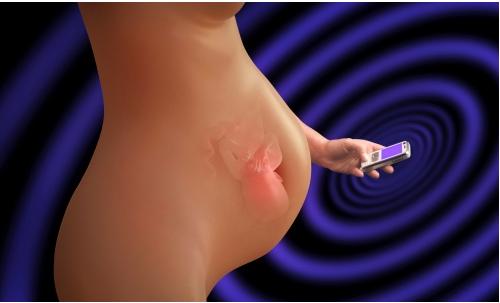 怀孕天天提心吊胆要崩溃,孕早期总是提心吊胆的怎么办