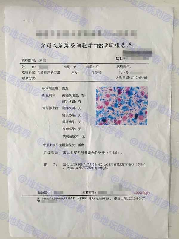 未育女性宫颈锥切,做过宫颈锥切后又感染hpv该怎么办