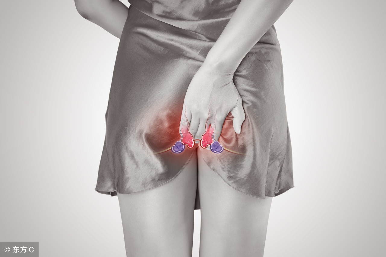 治疗痔疮肿痛的中药配方,治疗痔疮口服什么消肿药效果好