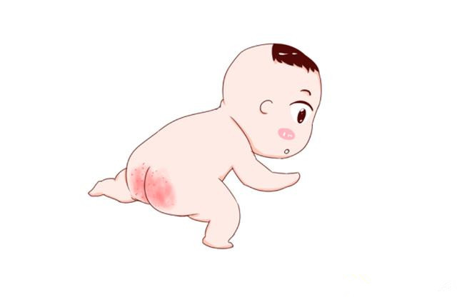 红屁屁怎么防治,红屁屁的原因及预防方法