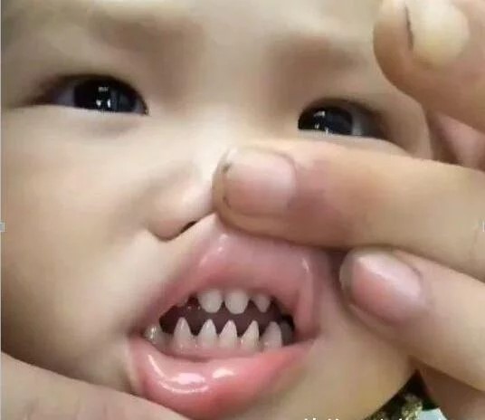 天哪~孩子为何长满尖牙？