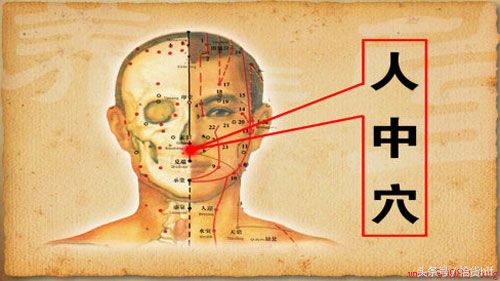 夏季中暑急救用品,夏季中暑后的应急措施