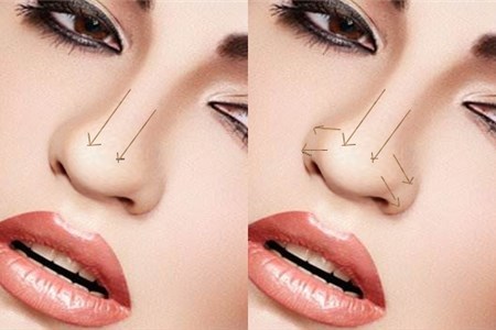 平鼻塌鼻梁怎么化妆才好看,塌鼻子鼻翼大怎么化妆