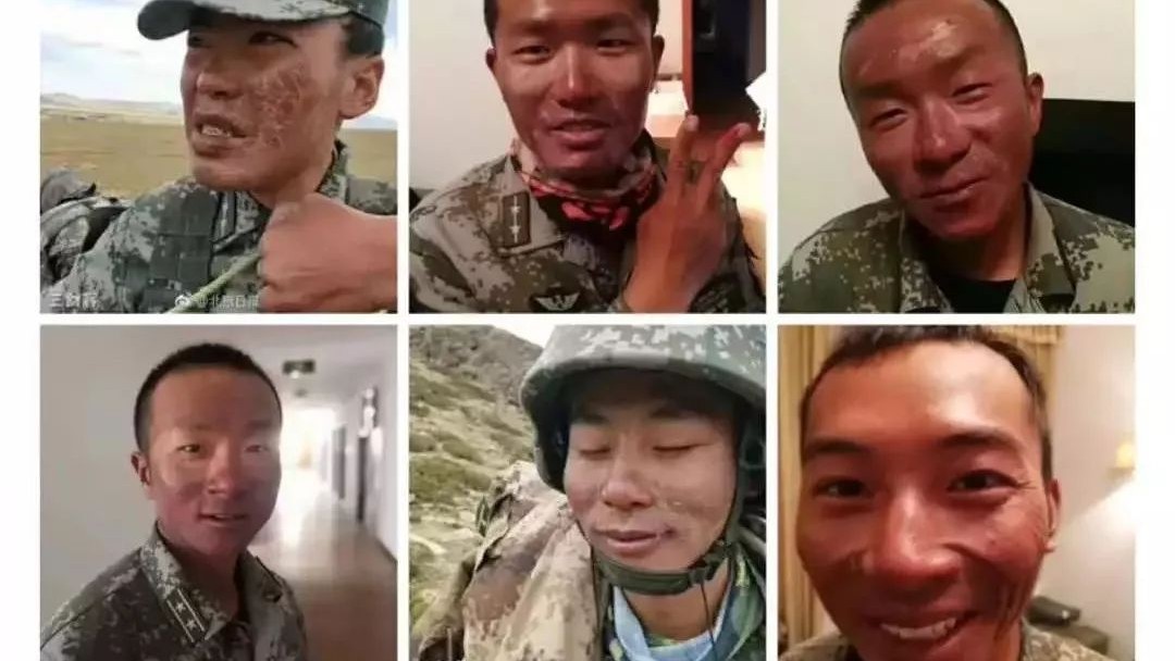 中国驻训高原官兵脸被灼伤,高原地区紫外线灼伤