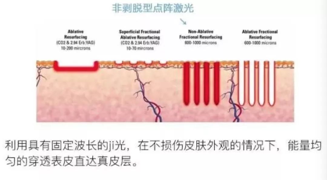 范冰冰拿下新代言,范冰冰税务风波后首拿下大牌代言