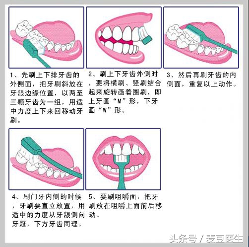 口腔溃疡特别疼怎么缓解,得了口腔溃疡怎样缓解疼痛更有效