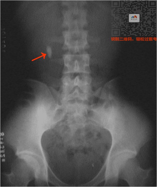 执医技能：X线阅片，全是套路，超简单