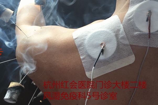 冬病夏治的黄金时间到了,不可错过的冬病夏治开始啦