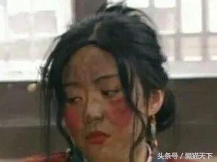 痘肌终结者视频,痘痘终结者