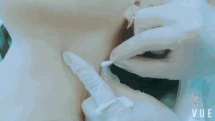 天津小白楼的神店！脱毛后瞬间白2度，原来女神夏天都……