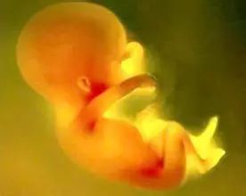 孕14周流产开什么证明,怀孕14周流产要开证明吗