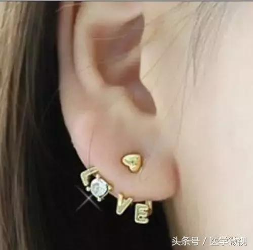 打耳洞真的能让视力变好吗,打耳洞真的对眼睛有好处吗