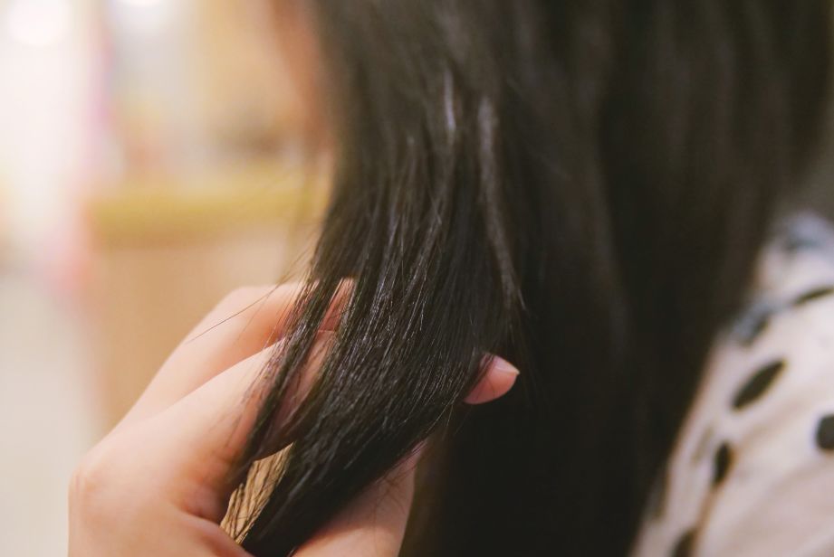 脱发、发际线高、地中海的克星！用它，1个月头发不掉了，不痒了，半年变浓密