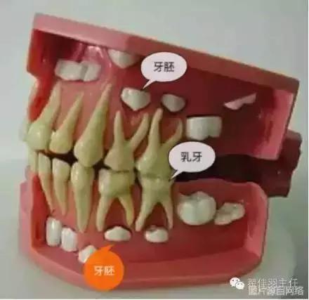 宝宝乳牙发黑换牙能好吗,乳牙龋病换牙后会好吗