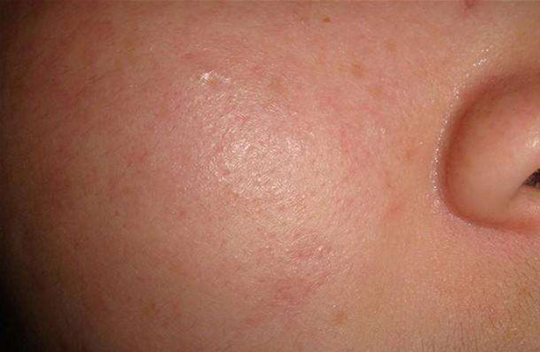 敏感体质看到一些东西,敏感肌看这里一日护肤指南