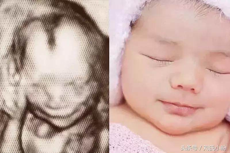 宝宝在肚子里胎动是怎样的,胎动时宝宝在肚子里做什么呀