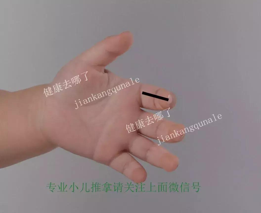 小儿睡觉易醒推拿哪些穴位,小儿睡眠障碍症怎么治疗