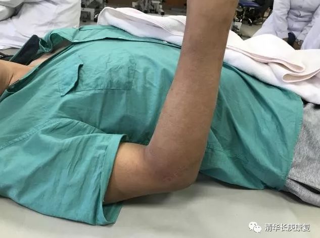 肌腱损伤的指南,长庚肌腱损伤康复训练