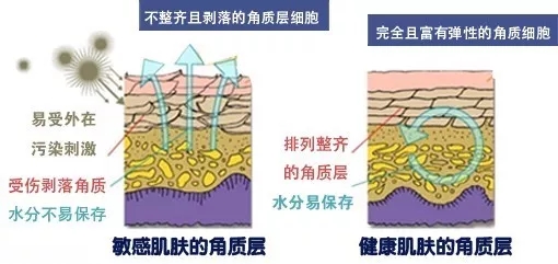 敏感肌肤应该怎么样温和去角质呢？该怎么操作才能避免烂脸？