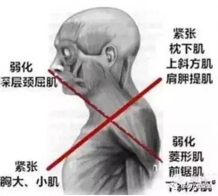脚趾为什么用不上力,大脚趾用不上力怎么回事