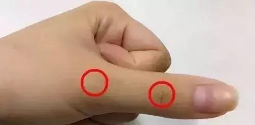 刮手指最有效的方法,手指刮一刮百病全能治