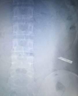 无论医生们警告多少次，直到今天，还有人吃它吃成肝衰竭……