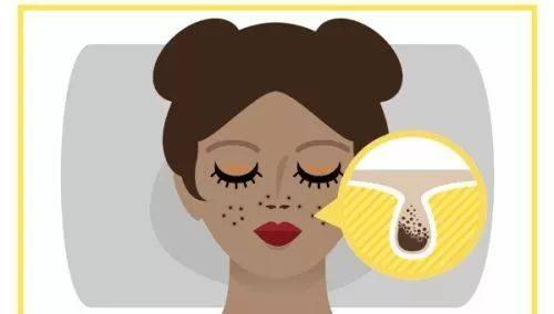 让毛孔变小的方法,生活中怎么注意才能使毛孔变小呢