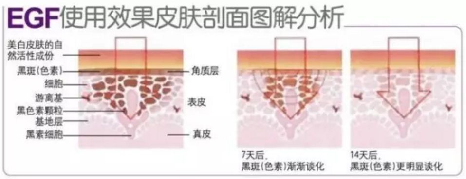 波兰美白面膜测评,德国抗老面膜推荐