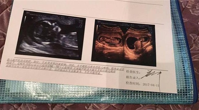产检费用好贵啊,2019最完整详细的孕期产检价格