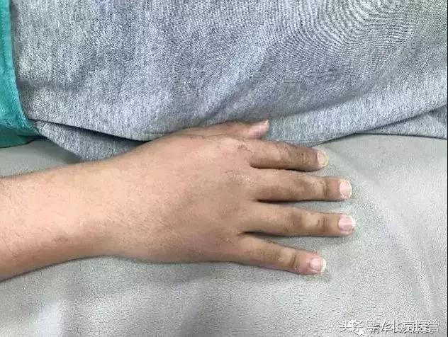 世界杯运动员损伤情况,世界杯球员受伤怎么处理