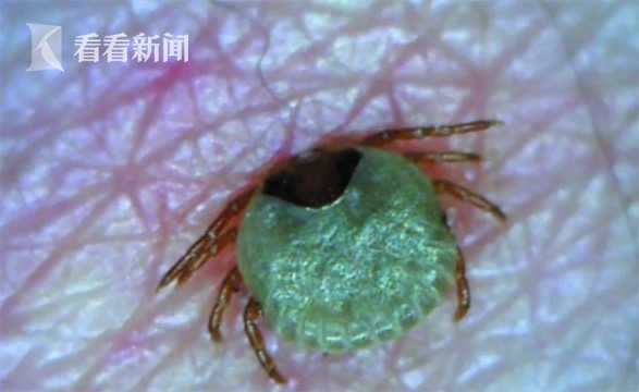 夺命蜱虫,蜱虫咬人一家几口死亡事件