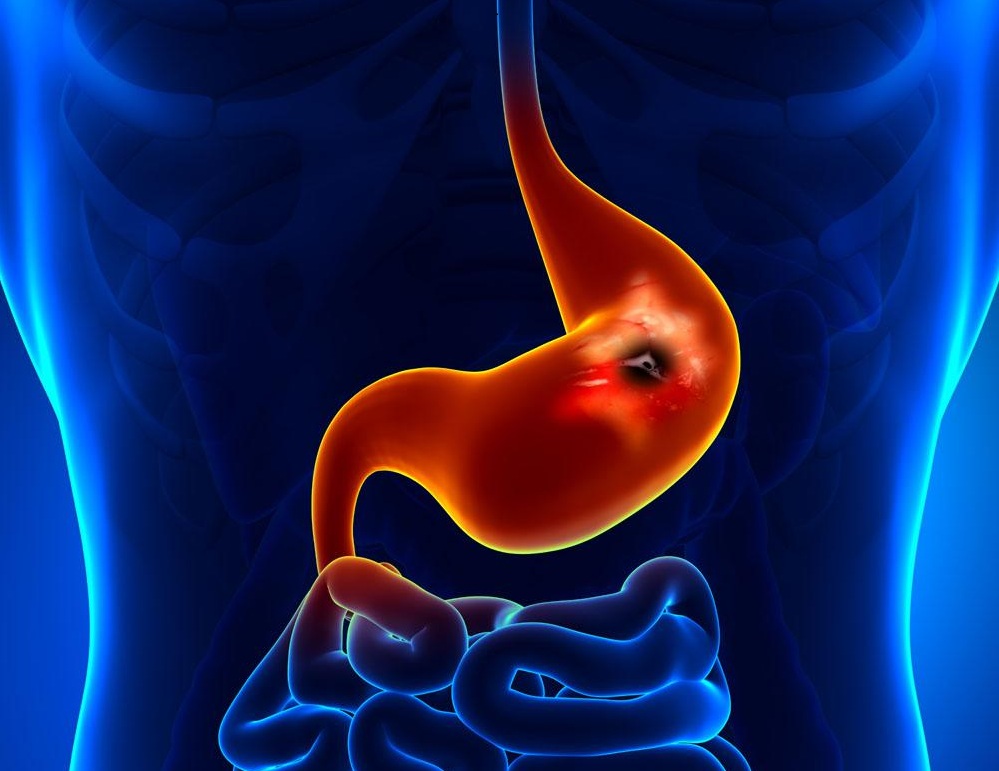 老胃病胃疼胃胀怎么回事,胃病可以吃的碱性蔬菜有哪些