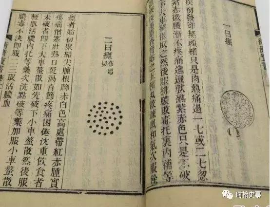 我的漫长抗癌之路 (漫长的抗癌之路)